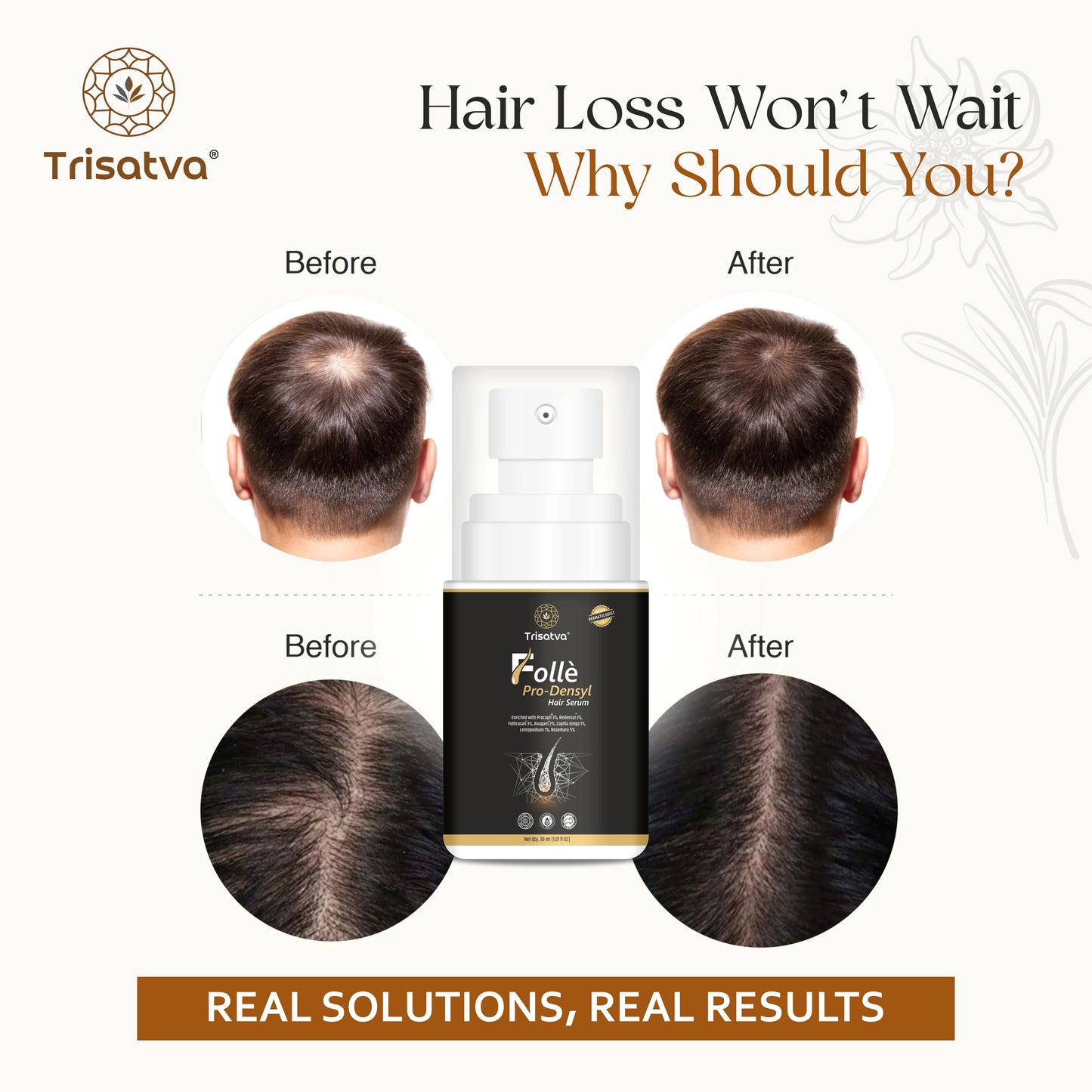 Trisatva Folle Pro-Densyl Hair Serum